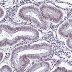 PSMA7 Antibody in Immunohistochemistry (Paraffin) (IHC (P))