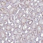 PSMA7 Antibody in Immunohistochemistry (Paraffin) (IHC (P))