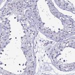 PSMA7 Antibody in Immunohistochemistry (Paraffin) (IHC (P))