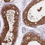 OR11H1 Antibody in Immunohistochemistry (Paraffin) (IHC (P))