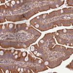 SCARA3 Antibody in Immunohistochemistry (Paraffin) (IHC (P))