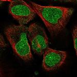 AMPD3 Antibody in Immunocytochemistry (ICC/IF)