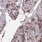 AMPD3 Antibody in Immunohistochemistry (Paraffin) (IHC (P))