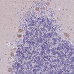 PIGM Antibody in Immunohistochemistry (IHC)