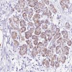 PTBP2 Antibody in Immunohistochemistry (Paraffin) (IHC (P))