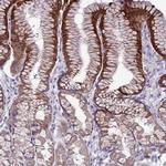 SLC44A3 Antibody in Immunohistochemistry (IHC)