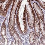 SLC44A3 Antibody in Immunohistochemistry (IHC)