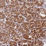 SLC44A5 Antibody in Immunohistochemistry (Paraffin) (IHC (P))