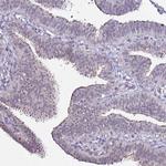 DUSP28 Antibody in Immunohistochemistry (Paraffin) (IHC (P))