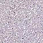 DUSP28 Antibody in Immunohistochemistry (Paraffin) (IHC (P))