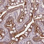 DUSP28 Antibody in Immunohistochemistry (Paraffin) (IHC (P))