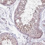 DUSP28 Antibody in Immunohistochemistry (Paraffin) (IHC (P))