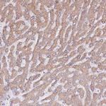 HSD17B7 Antibody in Immunohistochemistry (IHC)