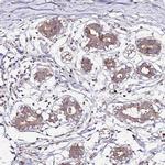 HSD17B7 Antibody in Immunohistochemistry (IHC)