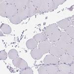 Cytochrome B5 Antibody in Immunohistochemistry (IHC)