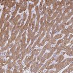 Cytochrome B5 Antibody in Immunohistochemistry (IHC)