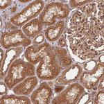 USE1 Antibody in Immunohistochemistry (Paraffin) (IHC (P))