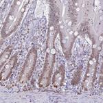 DHX37 Antibody in Immunohistochemistry (IHC)