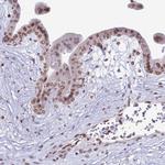 DHX37 Antibody in Immunohistochemistry (IHC)