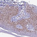 DHX37 Antibody in Immunohistochemistry (IHC)