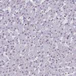 DHX37 Antibody in Immunohistochemistry (IHC)