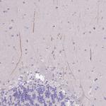 IGFL4 Antibody in Immunohistochemistry (Paraffin) (IHC (P))