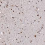 PADI2 Antibody in Immunohistochemistry (Paraffin) (IHC (P))