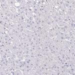 PADI2 Antibody in Immunohistochemistry (Paraffin) (IHC (P))