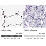 NAPSA Antibody in Immunohistochemistry (IHC)