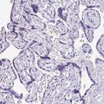 NAPSA Antibody in Immunohistochemistry (IHC)