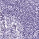 NAPSA Antibody in Immunohistochemistry (IHC)