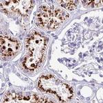 NAPSA Antibody in Immunohistochemistry (IHC)