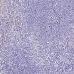 PCCA Antibody in Immunohistochemistry (IHC)