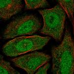 CABYR Antibody in Immunocytochemistry (ICC/IF)