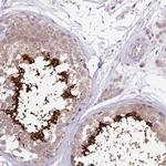 CABYR Antibody in Immunohistochemistry (Paraffin) (IHC (P))