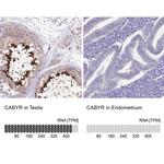 CABYR Antibody in Immunohistochemistry (IHC)