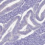 CABYR Antibody in Immunohistochemistry (IHC)