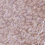 ZC3H13 Antibody in Immunohistochemistry (Paraffin) (IHC (P))