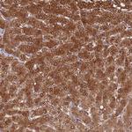 Alcohol Dehydrogenase 1A Antibody in Immunohistochemistry (Paraffin) (IHC (P))