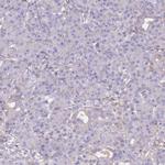 Alcohol Dehydrogenase 1A Antibody in Immunohistochemistry (Paraffin) (IHC (P))