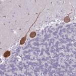 PPP1R17 Antibody in Immunohistochemistry (IHC)