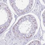 PPP1R17 Antibody in Immunohistochemistry (IHC)