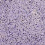 RAC1/RAC2/RAC3 Antibody in Immunohistochemistry (Paraffin) (IHC (P))