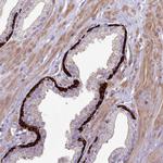 RAC1/RAC2/RAC3 Antibody in Immunohistochemistry (Paraffin) (IHC (P))