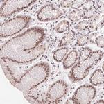 PRPF18 Antibody in Immunohistochemistry (Paraffin) (IHC (P))