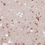 UGGT2 Antibody in Immunohistochemistry (Paraffin) (IHC (P))