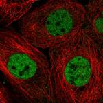 RBM7 Antibody in Immunocytochemistry (ICC/IF)