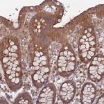 eIF2b beta Antibody in Immunohistochemistry (Paraffin) (IHC (P))