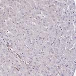 eIF2b beta Antibody in Immunohistochemistry (Paraffin) (IHC (P))