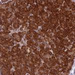 eIF2b beta Antibody in Immunohistochemistry (Paraffin) (IHC (P))